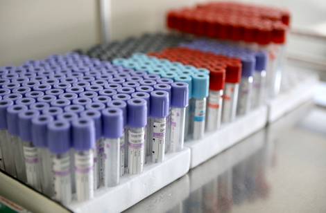 На Сахалине открывают новую лабораторию для исследования на коронавирус