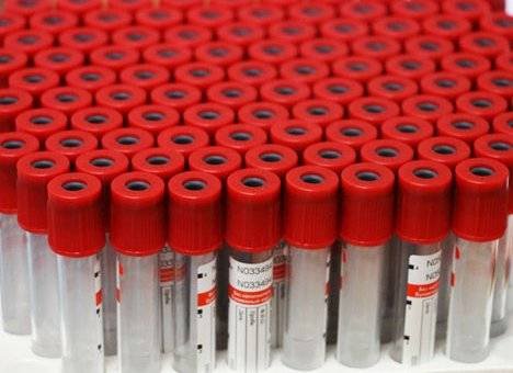 COVID-19: В Приморье за сутки выявлено 112 новых случаев коронавируса
